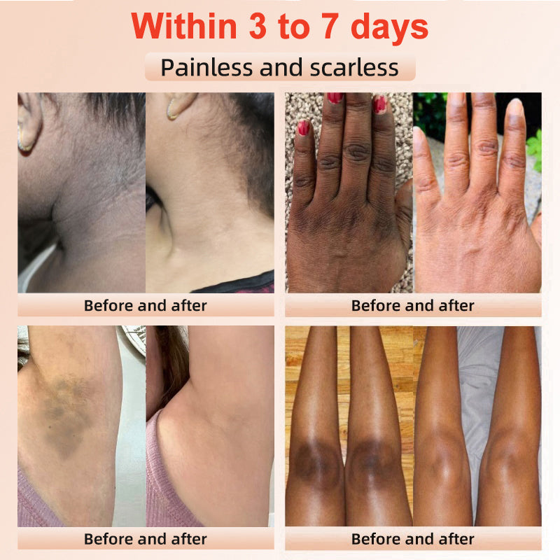 LOVILDS™ | Gel Esfoliante e Illuminante