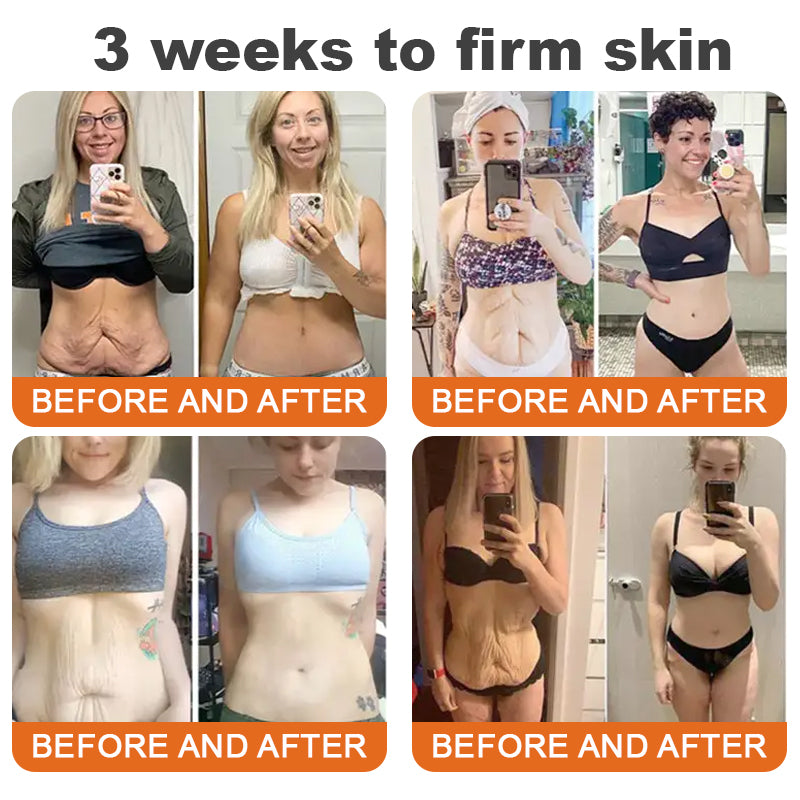 BeeBotox | Crema Anti-Age con Veleno d'Api e Botox