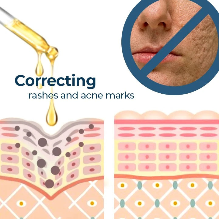 NiaTurm | Siero di Curcuma e Niacinamide per Ridurre le Macchie Scure sul Viso