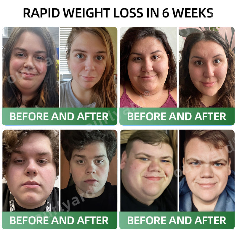 Gocce Dietetiche di Meglutide | Il Supporto Naturale per una Perdita di Peso Duratura