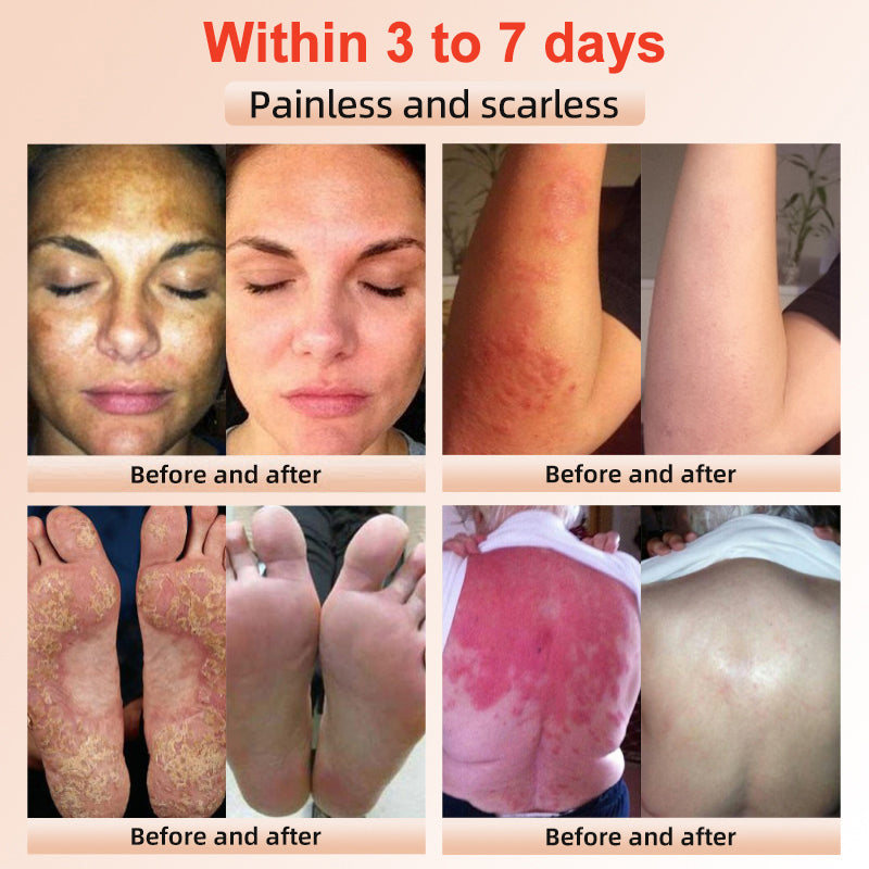 LOVILDS™ | Gel Esfoliante e Illuminante