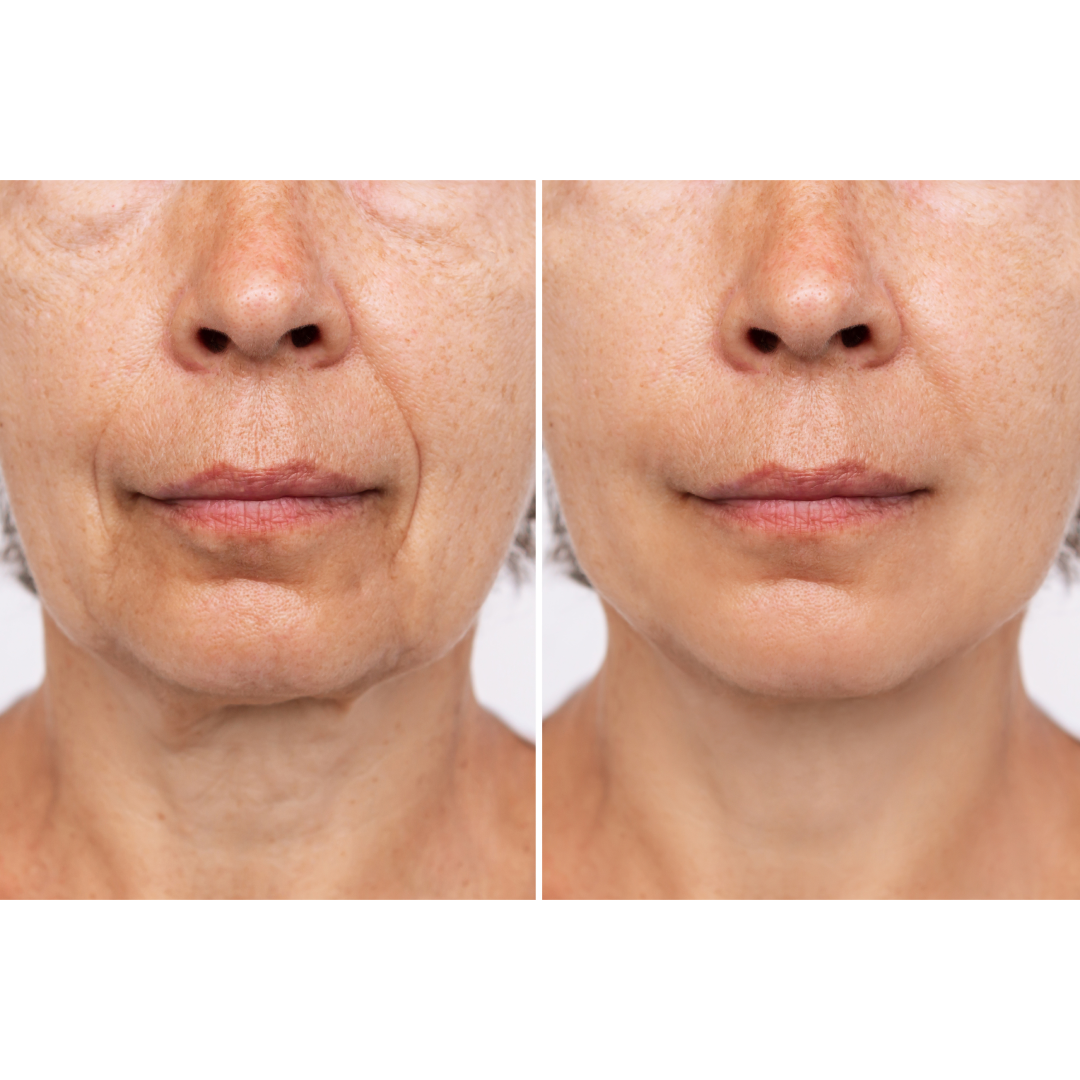 RadiancePulse™ | Massaggiatore Facciale Elettrico