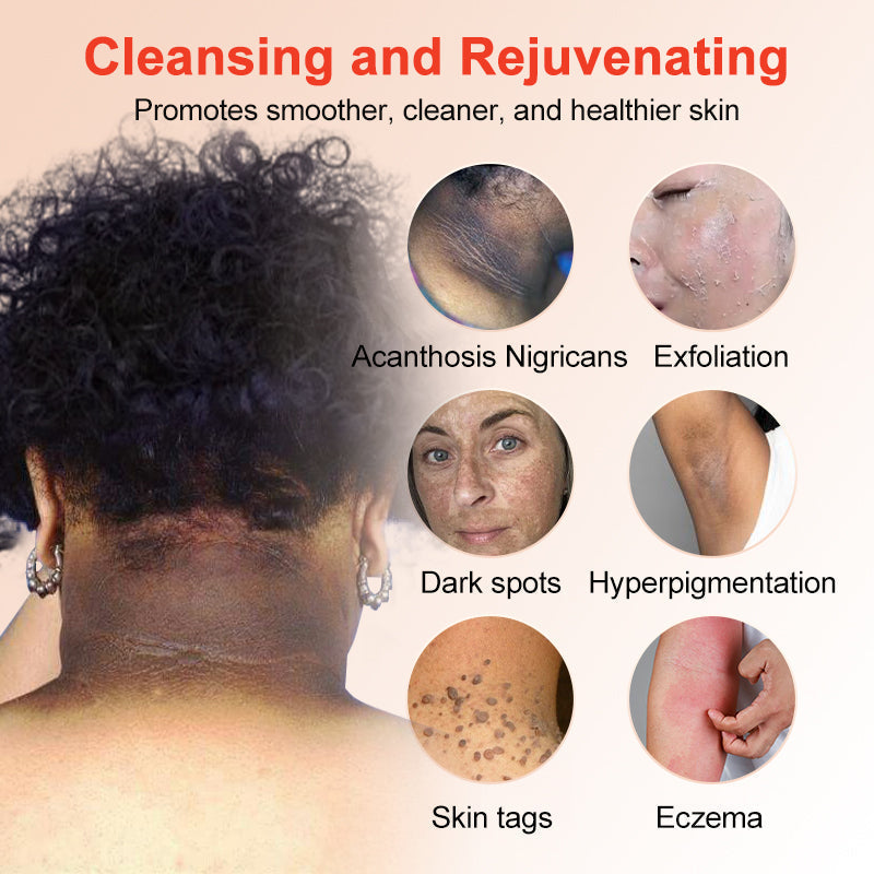 LOVILDS™ | Gel Esfoliante e Illuminante