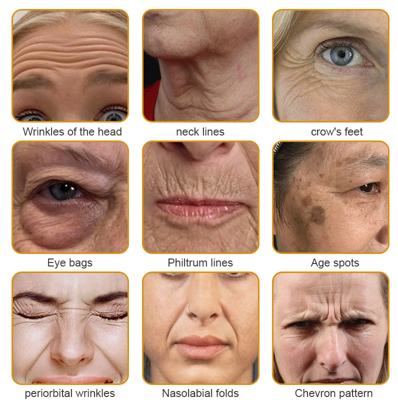 Crema BeeBotox | Crema Anti-Aging con Veleno d'Api e Botox