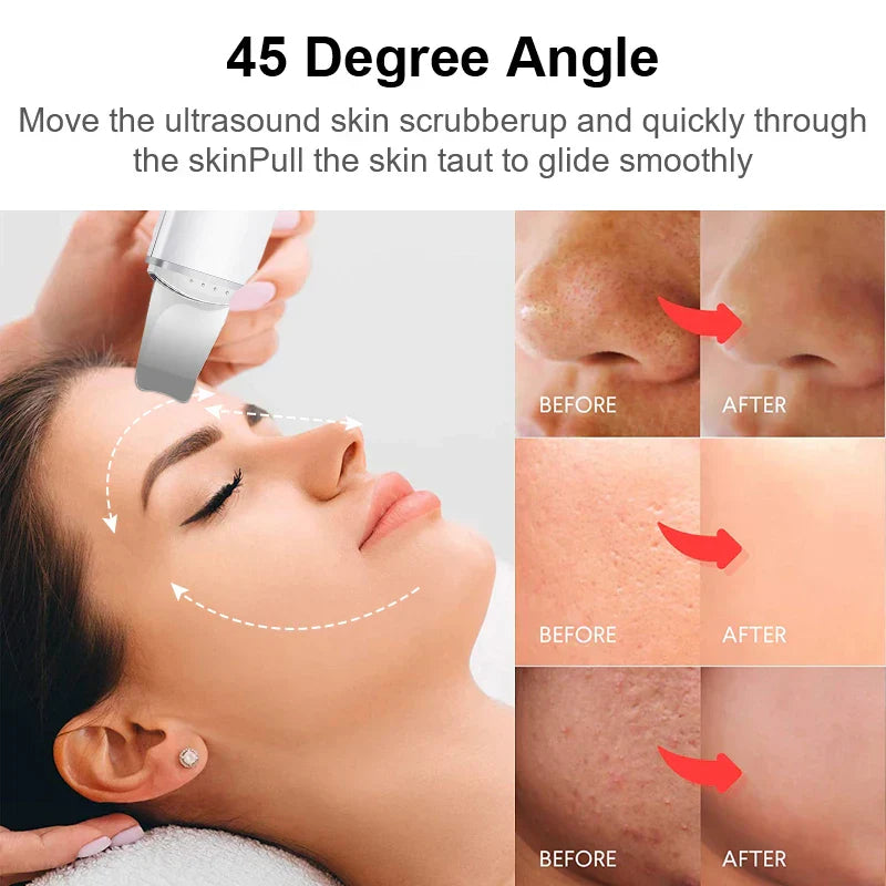 DermaWave™ | Scrubber Ultrasonico per la Pelle