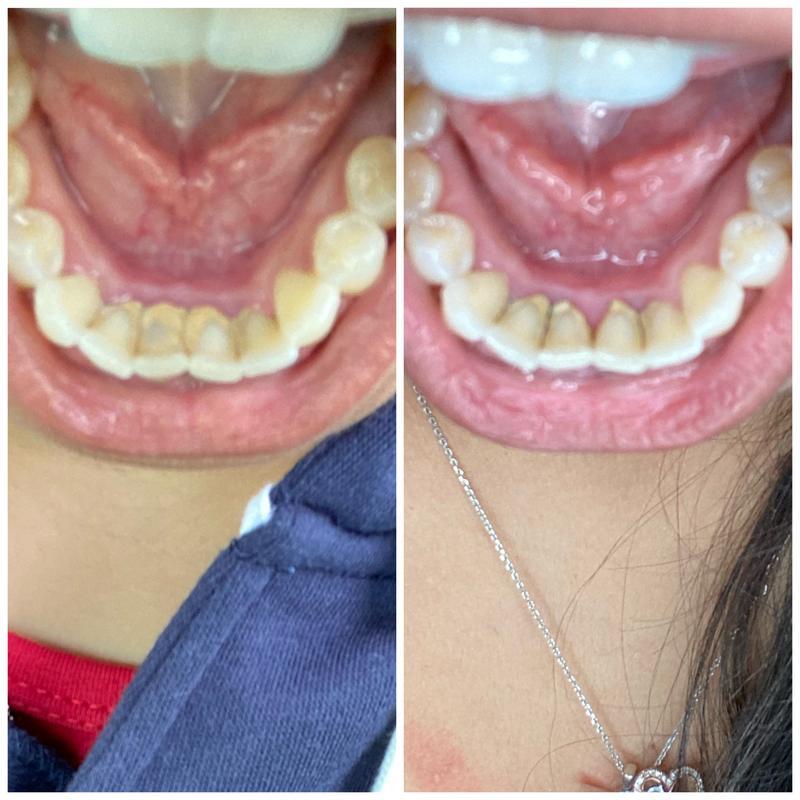 CocoNature | Collutorio all'Olio di Cocco per Denti più Puliti