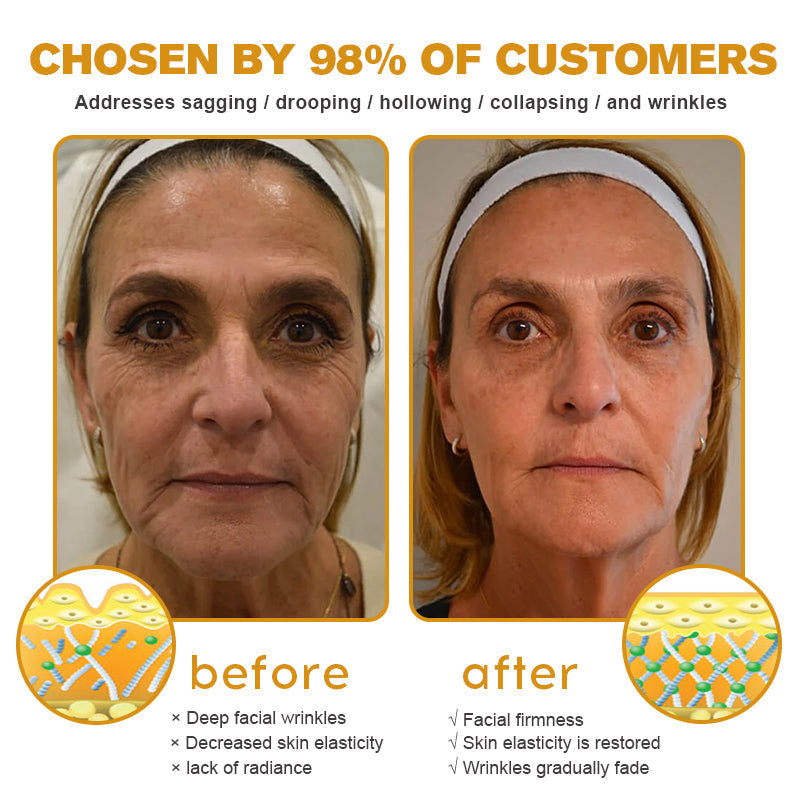 Crema BeeBotox | Crema Anti-Aging con Veleno d'Api e Botox