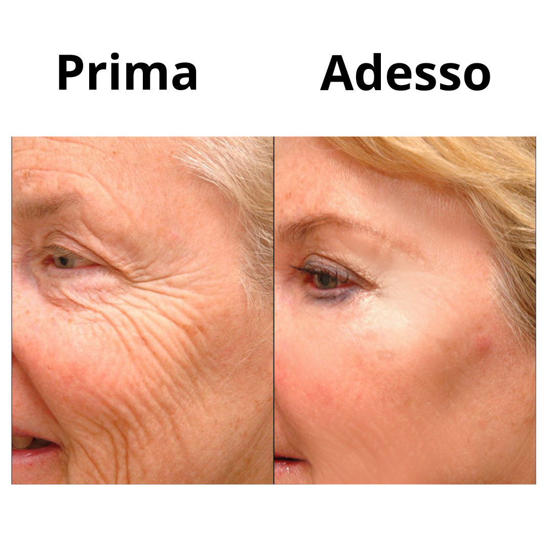 InstantLift™ | Crema Tensore Temporanea Istantanea per il Viso