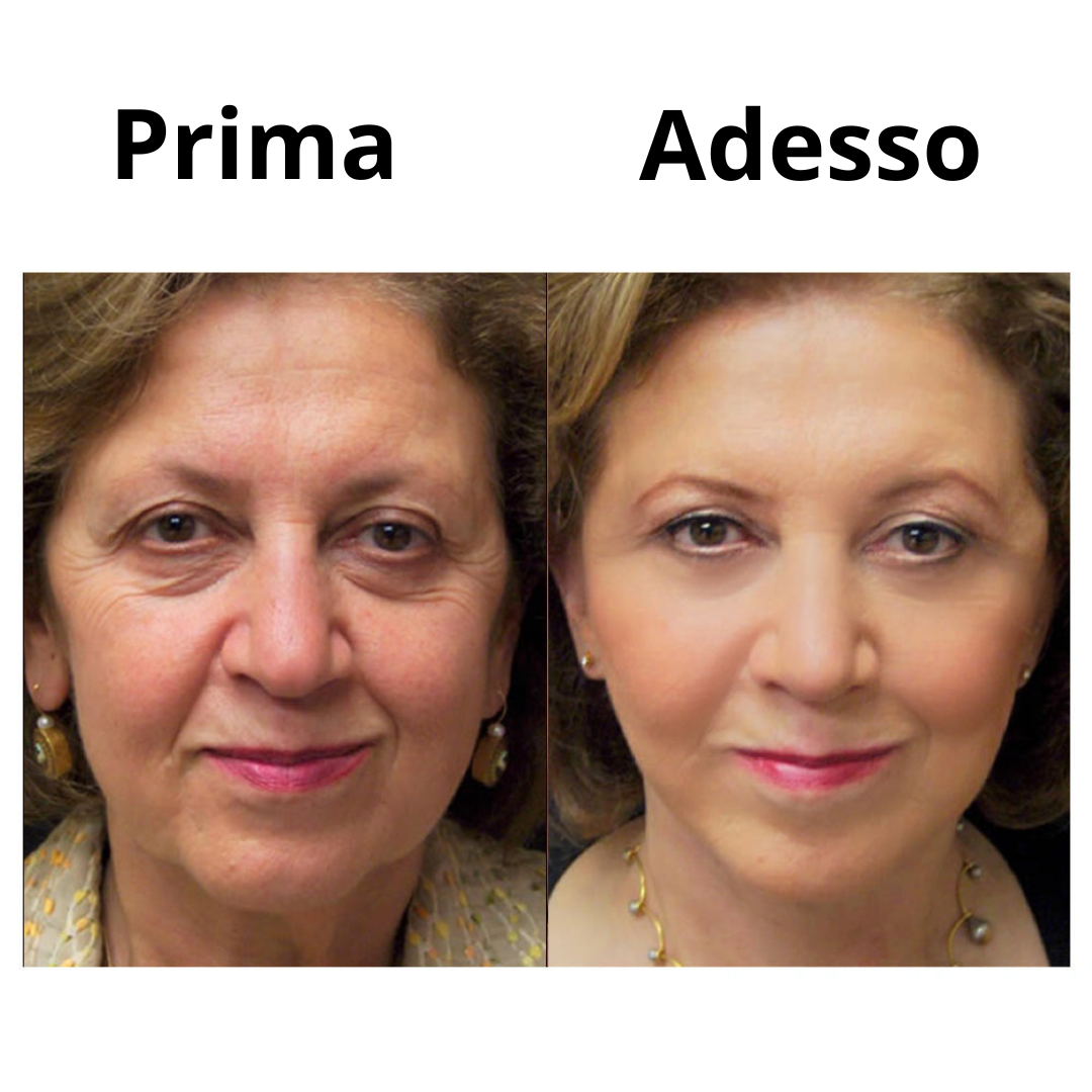 InstantLift™ | Crema Tensore Temporanea Istantanea per il Viso