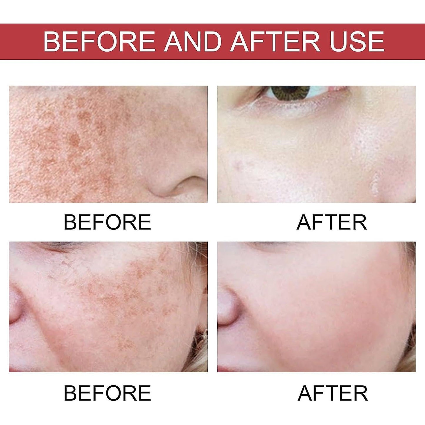 Bella™ | Siero Viso per Macchie Scure