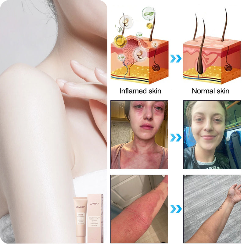 LOVILDS™ | Gel Esfoliante e Illuminante