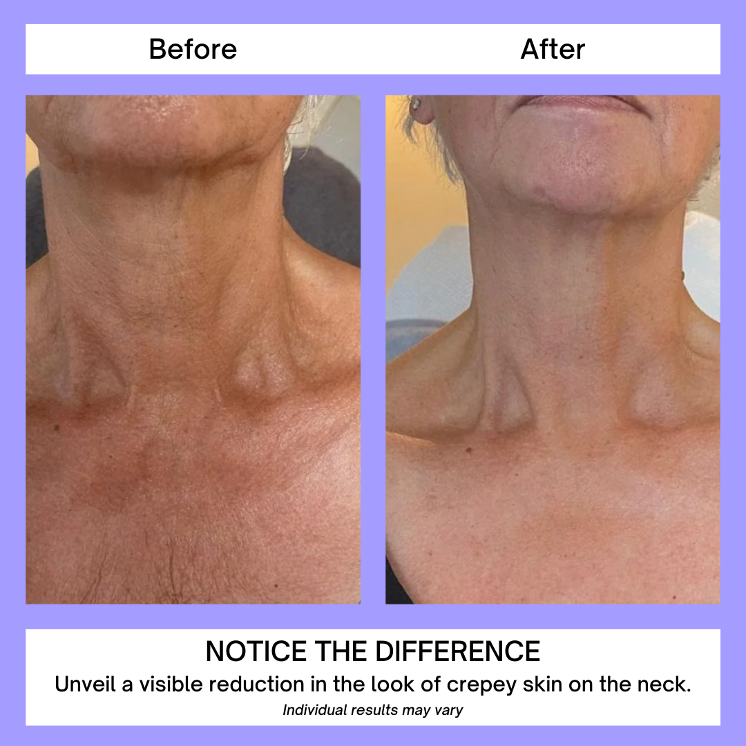 FirmNeck™ | Crema Liftante per il Collo