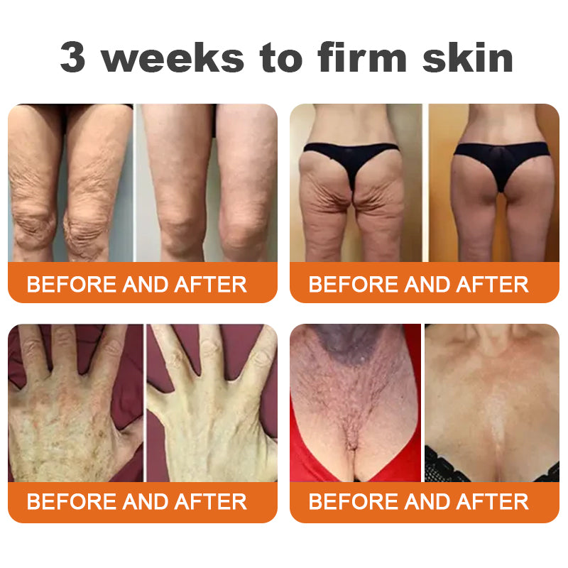 BeeBotox | Crema Anti-Age con Veleno d'Api e Botox