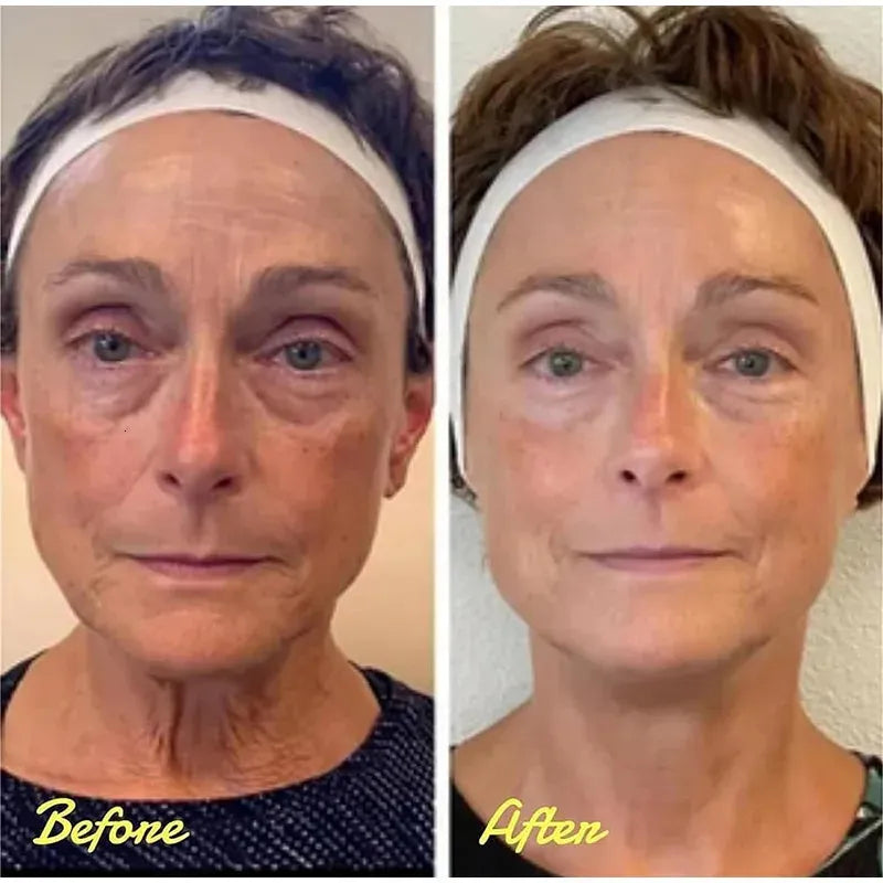 InstaCream™ | Crema Anti-Occhiaie e Antirughe