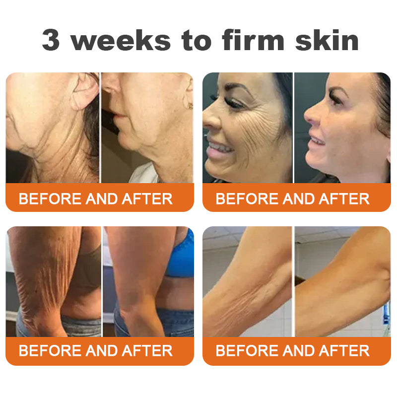 BeeBotox | Crema Anti-Age con Veleno d'Api e Botox