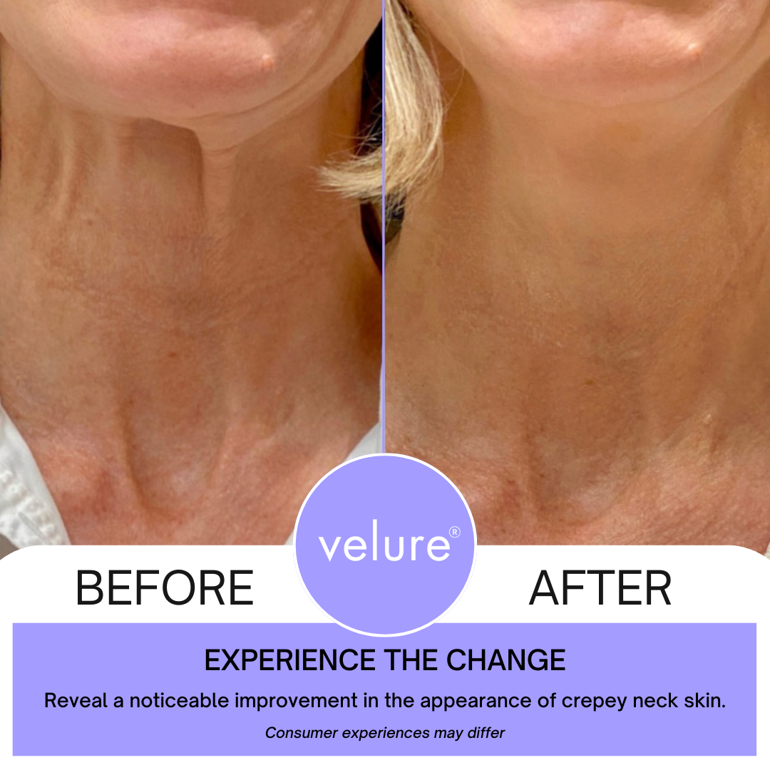 FirmNeck™ | Crema Liftante per il Collo