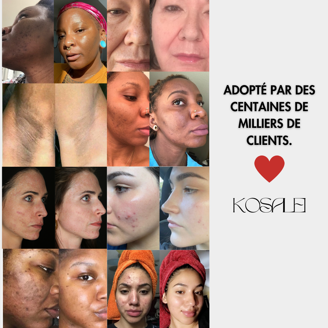 Cotons Glow Up™ | Dischetti di Cotone Illuminanti con Curcuma e Acido Kojico