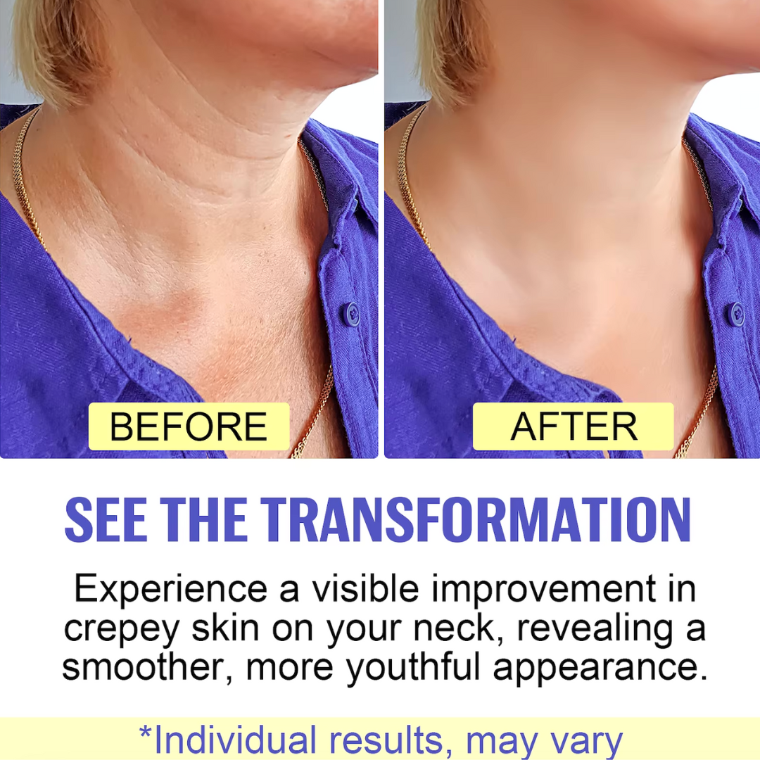 FirmNeck™ | Crema Liftante per il Collo