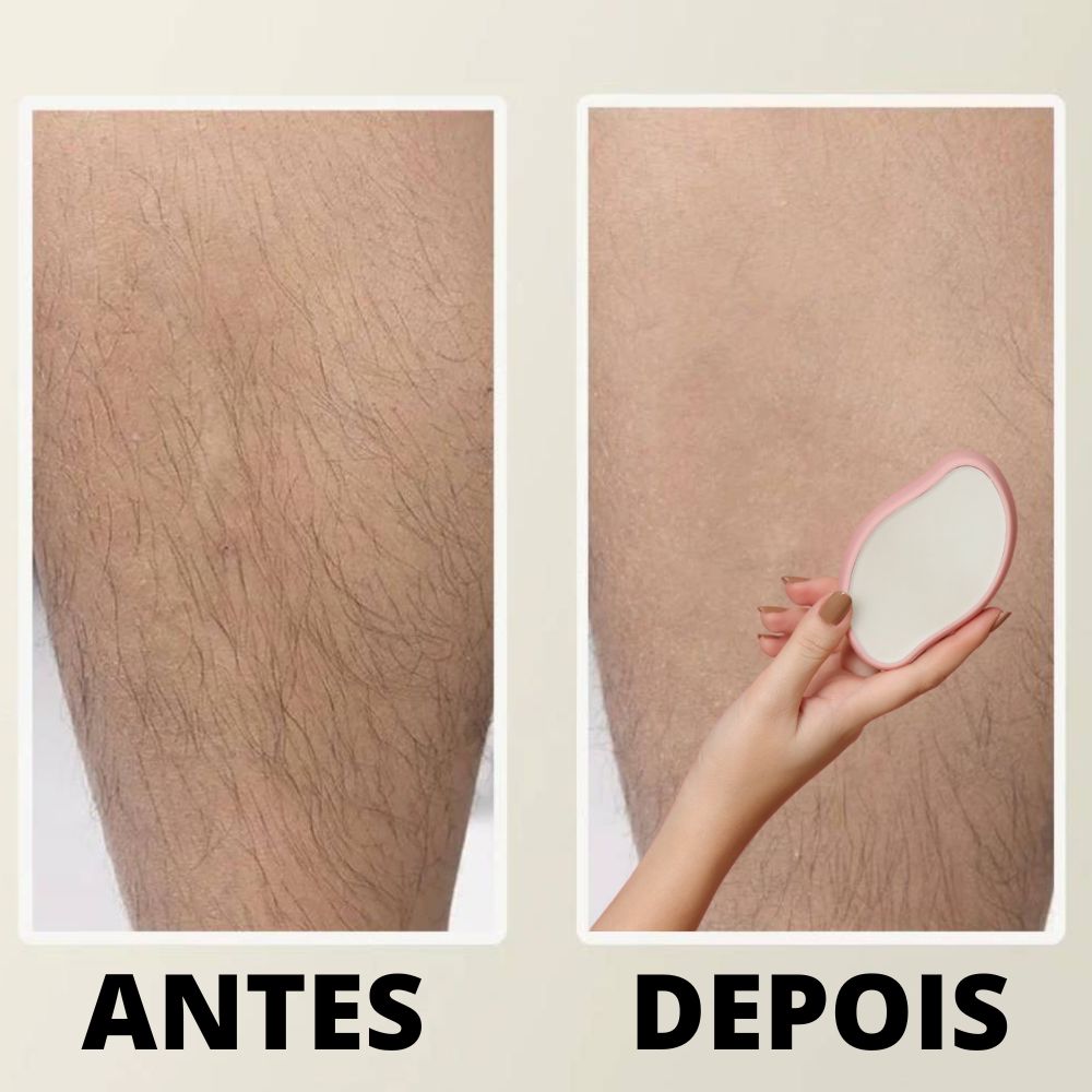 SilkyErase™ | Rimuovi Peli e Esfoliante Cristallino