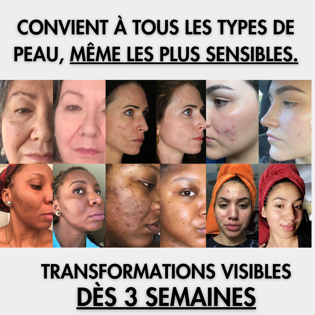 Cotons Glow Up™ | Dischetti di Cotone Illuminanti con Curcuma e Acido Kojico