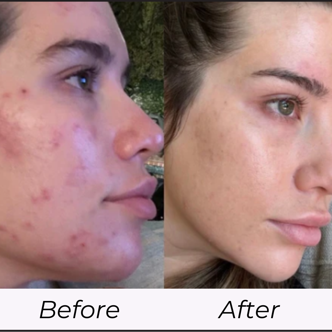 Pelle Radiosa in Minuti con la Maschera al Collagene LumiBelle™