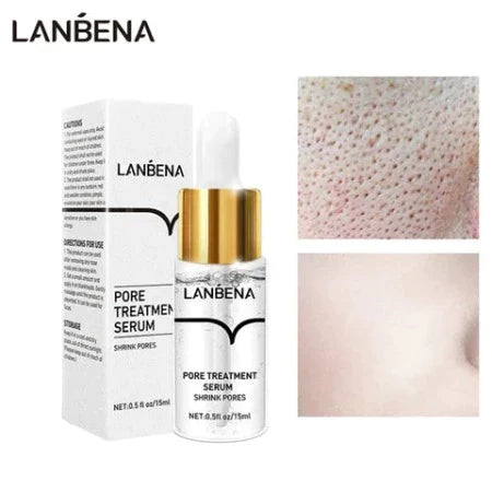Lanbena™ | Maschera per punti neri
