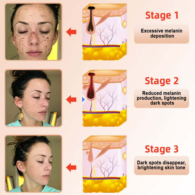 LOVILDS™ | Gel Esfoliante e Illuminante