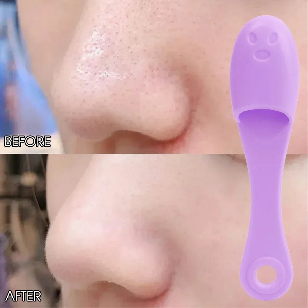 LumiScrub™ | Pulitore per il Viso in Silicone e Rimuovi Punti Neri