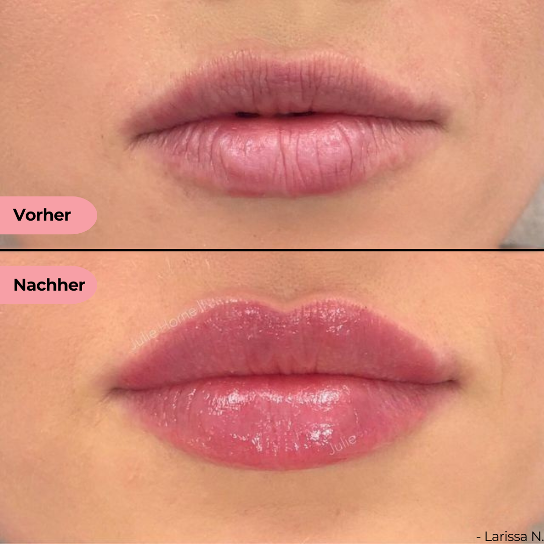 PeelContour Ink™ | Lipliner Tattoo