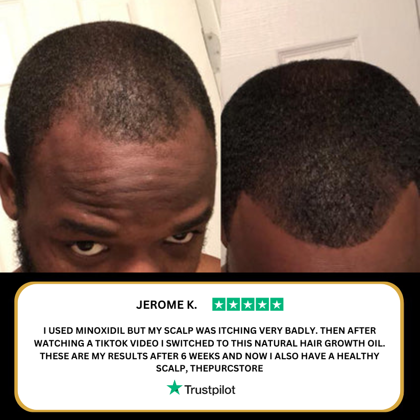 VitaBeam™ | Massaggiatore Elettrico per Cuoio Capelluto